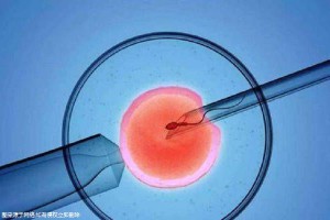 关于供卵代孕要多少费用